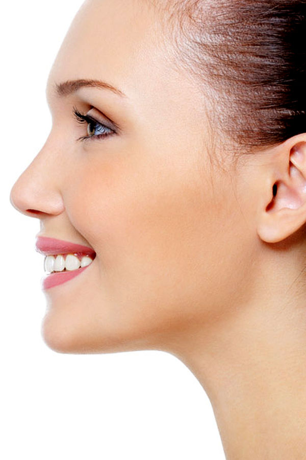 Rinoplastia - mejora aspecto de nariz